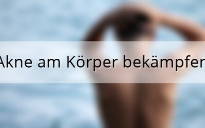 BEAUTY// Akne am Körper bekämpfen | Presse
