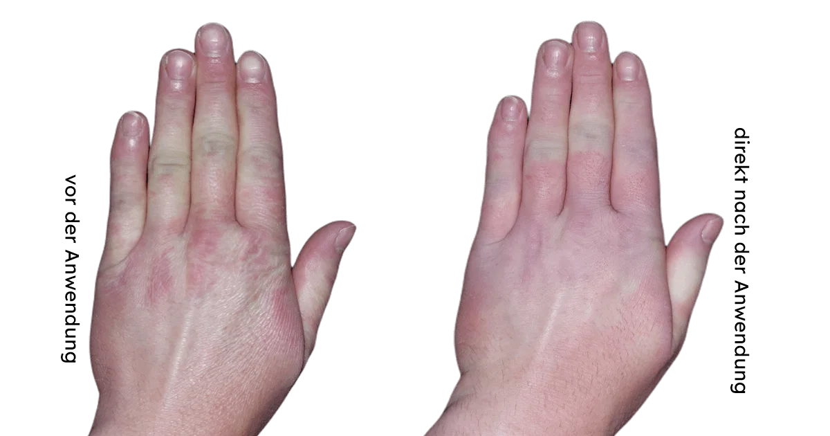 baleahandschuhmaskeureaapplikation